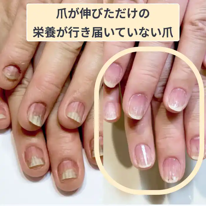 リカバリー4か月プログラム