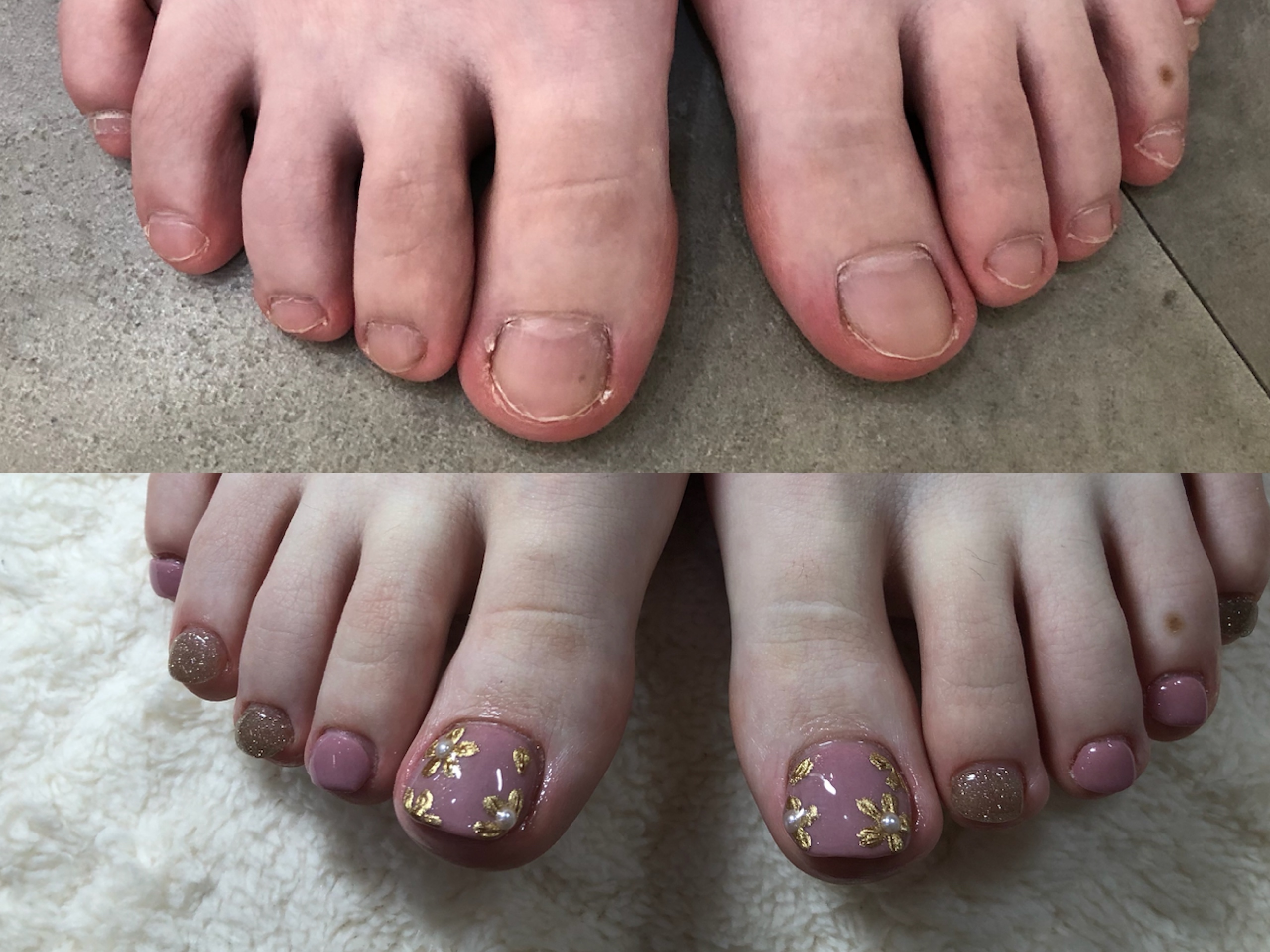 諦めていたネイルも楽しめる