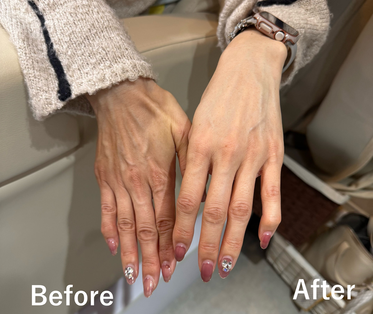 ディープクレンジングのビフォーアフター