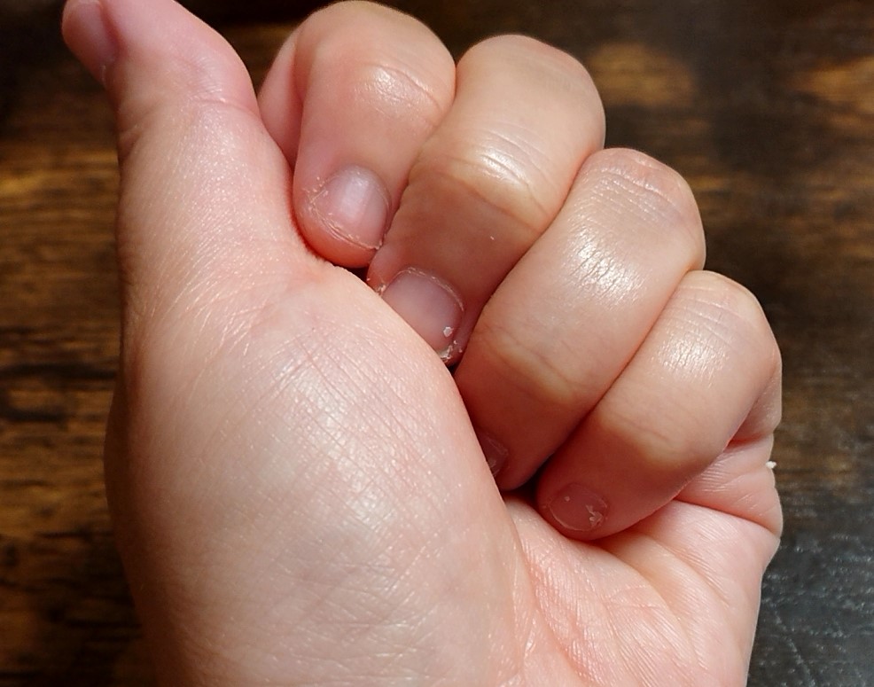 深爪の子供の手